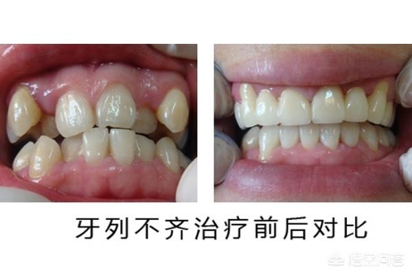德清最新24小时牙医在线咨询方法分析(最方便真实的德清有没有24小时牙医方法)